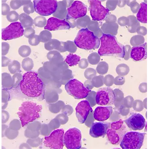 C8166 人T细胞性白血病细胞