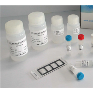 大鼠利钠肽受体β(NPR-β)ELISA试剂盒