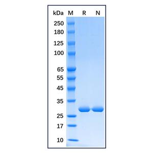aladdin 阿拉丁 rp176715 Recombinant Human Heme Oxygenase 1 Protein Carreir Free, >98% (SDS-PAGE), E.coli, His tag, 1-261 aa