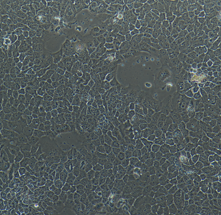 人脑髓母细胞瘤细胞D341Med,D341Med