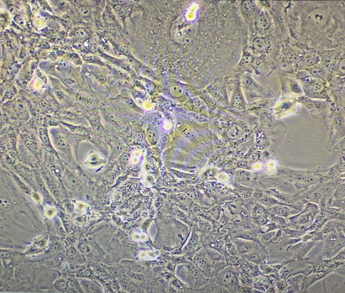 人肝内胆管癌细胞HuCCT1,HuCCT1