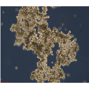 人胚胎橫紋肌肉瘤細(xì)胞A204，ATCC來源