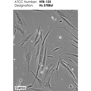 人子宫鳞癌细胞(高分化)HCC94，ATCC来源