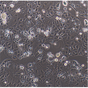 人胚肺成纤维细胞HFL1,HFL1