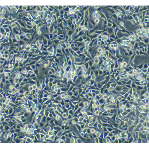 人骨肉瘤细胞HOS，ATCC来源