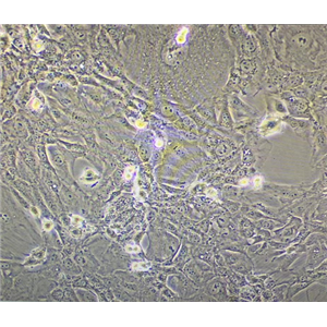 人肝内胆管癌细胞HuCCT1,HuCCT1