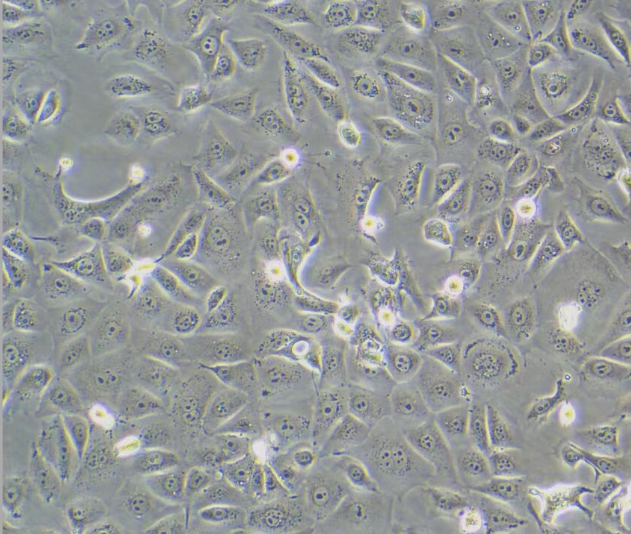 人胚肺成纤维细胞MRC5,MRC5