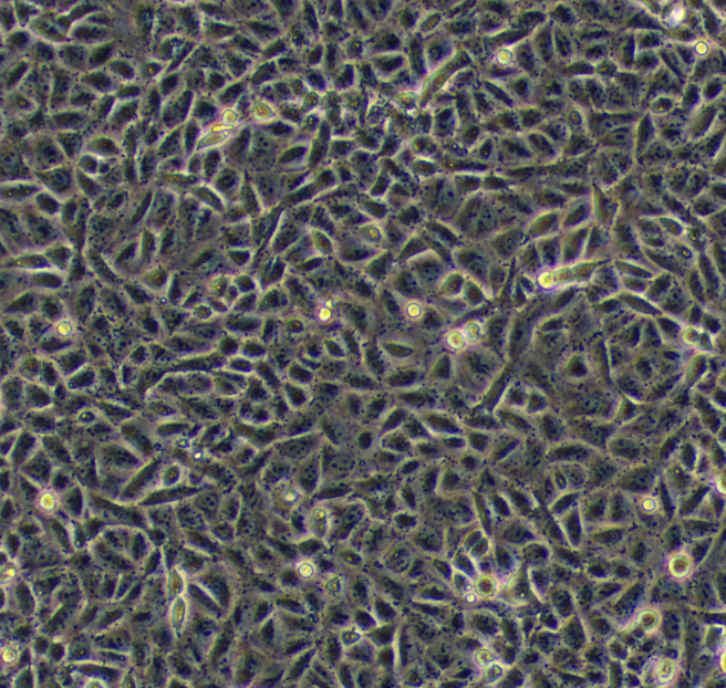 人正常結(jié)腸上皮細胞ncm460,ncm460