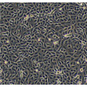 人肺腺癌細(xì)胞sklu1,sklu1