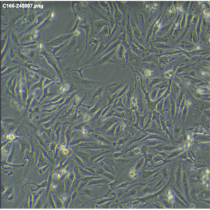 人脑星形胶质母细胞瘤U118MG，ATCC来源