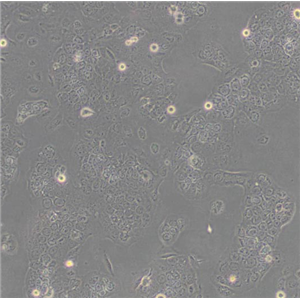 腺病毒转化的人胚肾细胞AAV293,AAV293