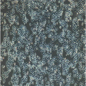 人肺成纤维细胞-原发性肺纤维化LL97A(AlMy),LL97A(AlMy)