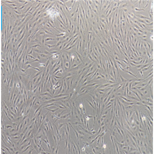 人乳腺癌細(xì)胞（三陰性）HCC1395，ATCC來源