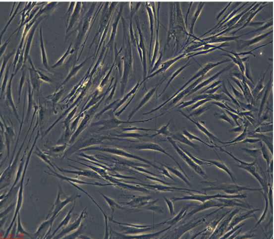 人肺腺癌細(xì)胞HCC95,HCC95