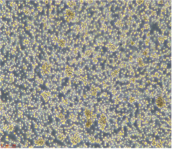 人非小细胞肺癌细胞NCIH810,EPLC272H