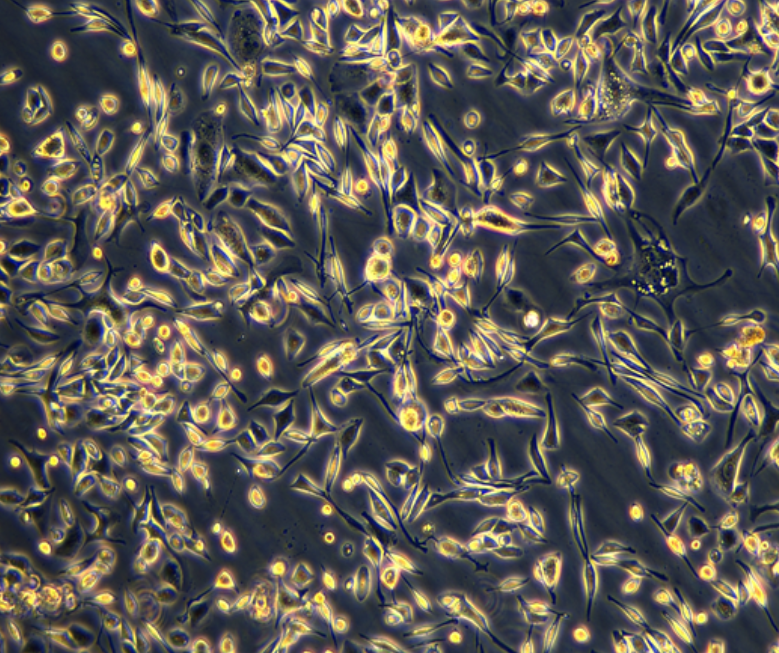 人濾泡狀甲狀腺癌細胞FTC238,FTC238