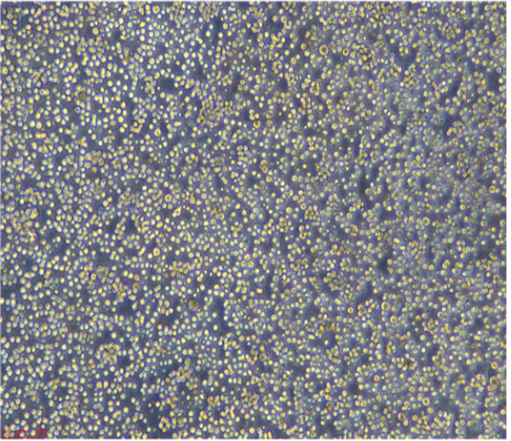 人乳腺癌細(xì)胞（三陰性）CAL51,CAL51