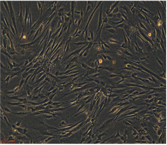 人肺癌腺癌貼壁細(xì)胞HCC1171,HCC1171