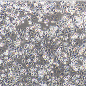 人肺腺癌细胞HCC4006，ATCC来源