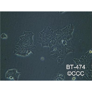 人乳腺癌细胞HCC1428，ATCC来源