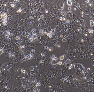 人卵巢癌细胞+耐顺铂SKOV3/ddp,SKOV3/ddp