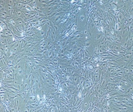 轉染了microRNA-mock基因的陰性對照細胞Hela-mock,Helamock