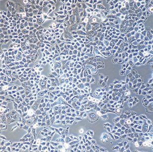 肾小球足细胞mousepodocyte,mousepodocyte