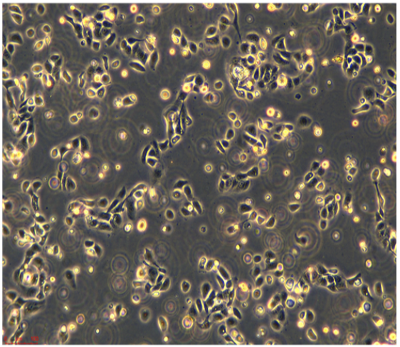 MHCC-LM3人高轉(zhuǎn)移潛能肝癌細(xì)胞,MHCCLM3