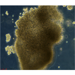 NIT-1小鼠胰島素瘤β細(xì)胞