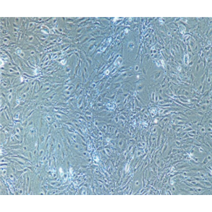 转染了microRNA-mock基因的阴性对照细胞Hela-mock