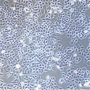 肾小球足细胞mousepodocyte