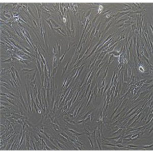 人印戒细胞胃腺癌SNU-601,NU601