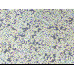 人乳腺癌細胞HCC1569