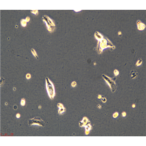 人乳腺导管癌细胞HCC1419，ATCC细胞