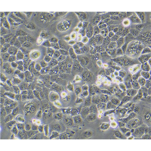 人肝内胆管癌细胞LICCF，ATCC细胞