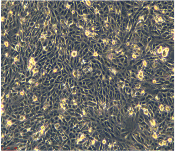 人肺腺癌細胞CL10,CL10