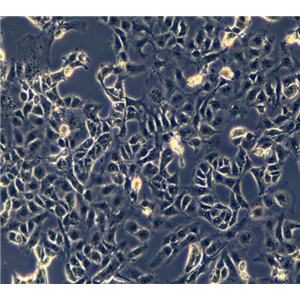 人晶状体上皮细胞FHL124，ATCC细胞