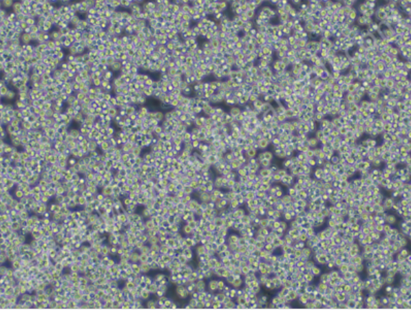 人星型胶质瘤细胞B2-17[B2-17],b217