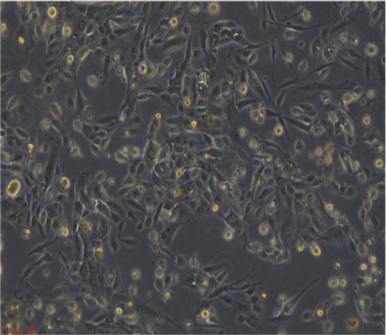 人肝癌細(xì)胞Hep3B2.17/LUC(帶熒光素酶),Hep3B217/LUC