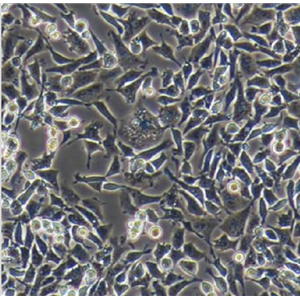 人成纤维细胞GM01176，ATCC细胞