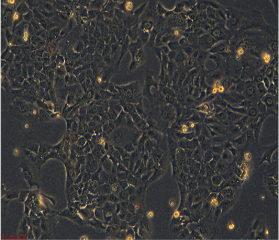 人乳腺癌细胞（三阴性）MDAKB2/LUC(带荧光素酶),MDAKB2/LUC