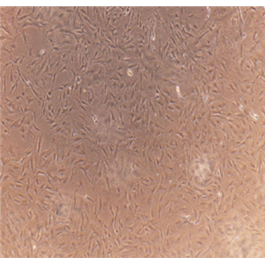 人皮膚成纖維細(xì)胞（有限細(xì)胞系）Hs865.Sk/LUC(帶熒光素酶),Hs865Sk/LUC