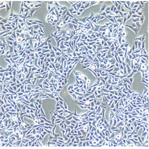 人肺鳞癌细胞NCIH2170/LUC(带荧光素酶),NCIH2170/LUC