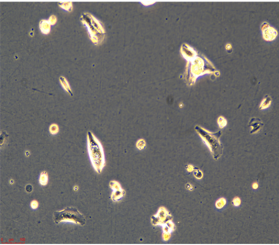 人乳腺原发性导管癌（三阴性）HCC1599/LUC(带荧光素酶),HCC1599/LUC