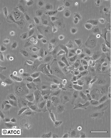 人乳腺癌細胞HCC1428/LUC(帶熒光素酶),HCC1428/LUC