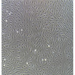 人卵巢腺癌細(xì)胞SW626/LUC(帶熒光素酶)