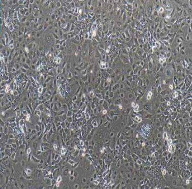 人結(jié)直腸腺癌細胞長春新堿耐藥株HCT-8/V/LUC(帶熒光素酶),HCT8V/LUC