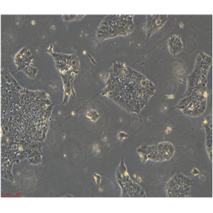 人肺巨細(xì)胞癌細(xì)胞PLA801D95D/LUC(帶熒光素酶)