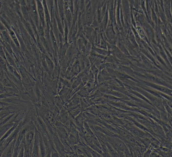 人口腔上皮癌细胞Ca922/LUC(带荧光素酶),Ca922/LUC