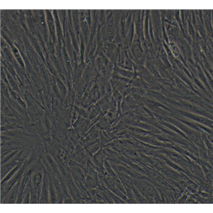 人口腔上皮癌细胞Ca922/LUC(带荧光素酶),Ca922/LUC